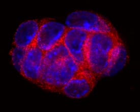 Immunocytochemistry 5T4 Antibody [Unconjugated]