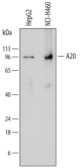 Western blot shows lysates of HepG2 human hepatocellular carcinoma cell line and NCI-H460 human large cell lung carcinoma cell line. PVDF membrane was probed with 2 µg/mL of Mouse Anti-Human A20/TNFAIP3 Monoclonal Antibody (Catalog # MAB7598) followed by HRP-conjugated Anti-Mouse IgG Secondary Antibody (HAF018). A specific band was detected for A20/TNFAIP3 at approximately 95 kDa (as indicated). This experiment was conducted under reducing conditions and using Immunoblot Buffer Group 1.