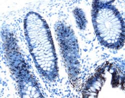 A33 was detected in immersion fixed paraffin-embedded sections of human colon using 1.7 &micro;g/mL Goat Anti-Human A33 Antigen Affinity-purified Polyclonal Antibody (Catalog # AF3080) overnight at 4 &deg;C. Tissue was stained with the Anti-Goat HRP-DAB Cell & Tissue Staining Kit (brown; CTS008) and counterstained with hematoxylin (blue). View our protocol for Chromogenic IHC Staining of Paraffin-embedded Tissue Sections.