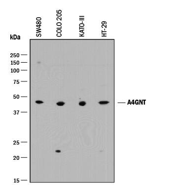Western Blot A4GNT Antibody [Unconjugated]