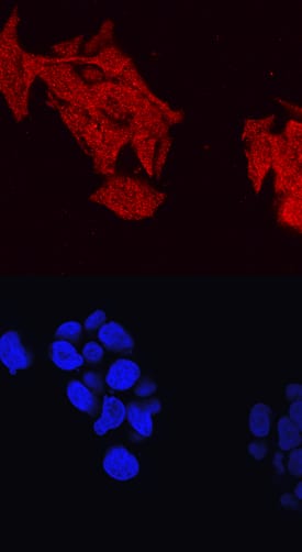 ABCA1 was detected in immersion fixed HepG2 human hepatocellular carcinoma cell line using Sheep Anti-Human ABCA1 Antigen Affinity-purified Polyclonal Antibody (Catalog # AF7207) at 10 µg/mL for 3 hours at room temperature. Cells were stained using the NorthernLights™ 557-conjugated Anti-Sheep IgG Secondary Antibody (red, upper panel; Catalog # NL010) and counterstained with DAPI (blue, lower panel). View our protocol for Fluorescent ICC Staining of Cells on Coverslips.