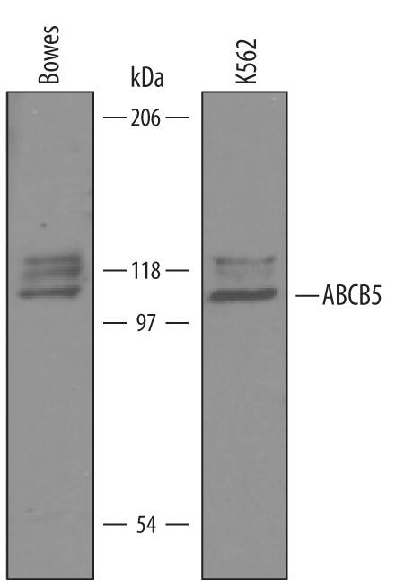 Western blot shows lysates of Bowes human melanoma cell line and K562 human chronic myelogenous leukemia cell line. PVDF Membrane was probed with 1 µg/mL of Human ABCB5 Antigen Affinity-purified Polyclonal Antibody (Catalog # AF5799) followed by HRP-conjugated Anti-Sheep IgG Secondary Antibody (Catalog # HAF016). A specific band was detected for ABCB5 at approximately 100-110 kDa (as indicated). This experiment was conducted under reducing conditions and using Immunoblot Buffer Group 8.