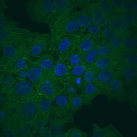 ATP-Binding Cassette Transporter G2 (ABCG2) was detected in immersion fixed JAR human choriocarcinoma cell line using Mouse Anti-Human ABCG2 Monoclonal Antibody (Catalog # MAB995) at 10 µg/mL for 3 hours at room temperature. Cells were stained using the NorthernLights™ 493-conjugated Anti-Mouse IgG Secondary Antibody (green; NL009) and counterstained with DAPI (blue). View our protocol for Fluorescent ICC Staining of Cells on Coverslips.