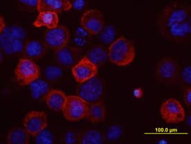 ABCG2 was detected in immersion fixed Human ABCG2 transfected CHO Chinese hamster ovary cell line using Mouse Anti-Human ABCG2 Monoclonal Antibody (Catalog # MAB995) at 10 µg/mL for 3 hours at room temperature. Cells were stained using the NorthernLights™ 557-conjugated Anti-Mouse IgG Secondary Antibody (red; NL007) and counterstained with DAPI (blue). View our protocol for Fluorescent ICC Staining of Cells on Coverslips.