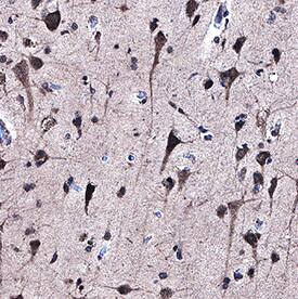 Immunohistochemistry ABI1 Antibody (1013203) [Unconjugated]