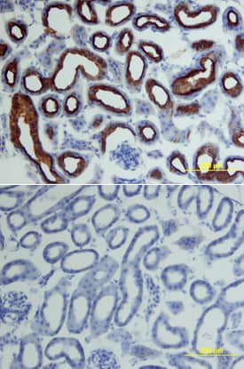 Immunohistochemistry ACE-2 Antibody [Unconjugated]