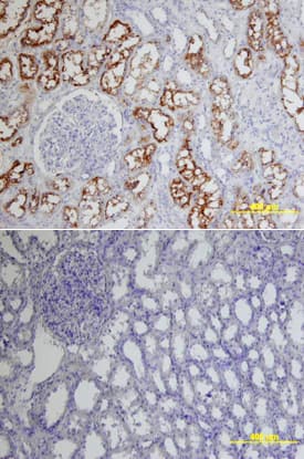 ACE-2 was detected in immersion fixed paraffin-embedded sections of human kidney using Goat Anti-Human/Mouse/Rat/Hamster ACE-2 Antigen Affinity-purified Polyclonal Antibody (Catalog # AF933) at 15 µg/mL overnight at 4 °C. Tissue was stained using the Anti-Goat HRP-DAB Cell & Tissue Staining Kit (brown; Catalog # CTS008) and counterstained with hematoxylin (blue). Lower panel shows a lack of labeling if primary antibodies are omitted and tissue is stained only with secondary antibody followed by incubation with detection reagents. View our protocol for Chromogenic IHC Staining of Paraffin-embedded Tissue Sections.