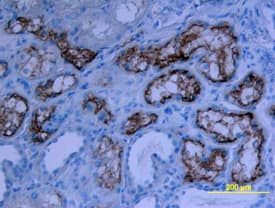 ACE-2 was detected in immersion fixed paraffin-embedded sections of human kidney using Goat Anti-Human/Mouse/Rat/Hamster ACE-2 Antigen Affinity-purified Polyclonal Antibody (Catalog # AF933) at 15 µg/mL overnight at 4 °C. Tissue was stained using the Anti-Goat HRP-DAB Cell & Tissue Staining Kit (brown; Catalog # CTS008) and counterstained with hematoxylin (blue). View our protocol for Chromogenic IHC Staining of Paraffin-embedded Tissue Sections.