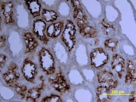 ACE-2 was detected in immersion fixed paraffin-embedded sections of human kidney using Human ACE-2 Biotinylated Antigen Affinity-purified Polyclonal Antibody (Catalog # BAF933) at 15 µg/mL overnight at 4 °C. Tissue was stained using the Anti-Goat HRP-DAB Cell & Tissue Staining Kit (brown; Catalog # CTS008) and counterstained with hematoxylin (blue). View our protocol for Chromogenic IHC Staining of Paraffin-embedded Tissue Sections.