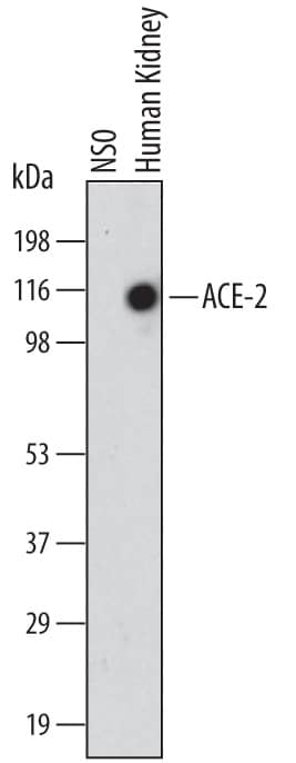 Western blot shows lysates of NS0 mouse myeloma cell line and human kidney tissue. PVDF membrane was probed with 2 µg/mL of Mouse Anti-Human ACE-2 Monoclonal Antibody (Catalog # MAB9331) followed by HRP-conjugated Anti-Mouse IgG Secondary Antibody (Catalog # HAF007). A specific band was detected for ACE-2 at approximately 110 kDa (as indicated). This experiment was conducted under reducing conditions and using Immunoblot Buffer Group 1.
