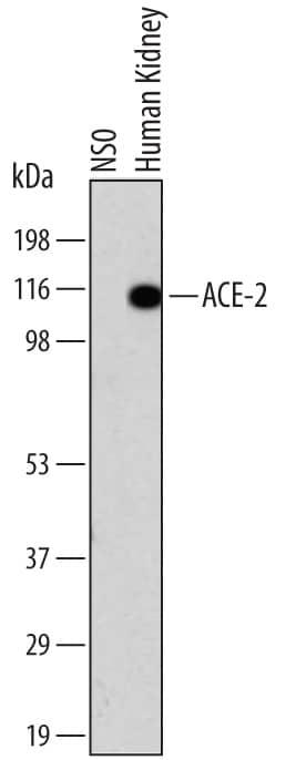 Western Blot ACE-2 Antibody (171606) [Unconjugated]
