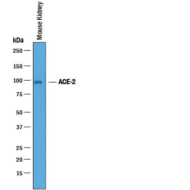 Western Blot ACE-2 Antibody [Unconjugated]