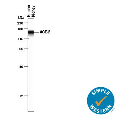 Simple Western lane view shows lysates of human kidney tissue, loaded at 0.2 mg/mL. A specific band was detected for ACE-2 at approximately 155 kDa (as indicated) using 10 µg/mL of Goat Anti-Human/Mouse/Rat/Hamster ACE-2 Antigen Affinity-purified Polyclonal Antibody (Catalog # AF933) followed by 1:50 dilution of HRP-conjugated Anti-Goat IgG Secondary Antibody (Catalog # HAF109). This experiment was conducted under reducing conditions and using the 12-230 kDa separation system.