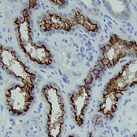Immunohistochemistry ACE-2 Antibody (171606) [Unconjugated]