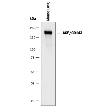 Western Blot ACE/CD143 Antibody [Unconjugated]