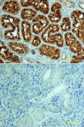 Immunohistochemistry ACE/CD143 Antibody [Unconjugated]