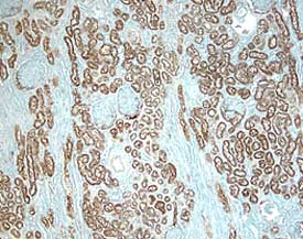 Immunohistochemistry ACE/CD143 Antibody [Unconjugated]