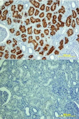 ACE/CD143 was detected in immersion fixed paraffin-embedded sections of human kidney using Goat Anti-Human ACE/CD143 Biotinylated Antigen Affinity-purified Polyclonal Antibody (Catalog # BAF929) at 15 µg/mL overnight at 4 °C. Tissue was stained using the Anti-Goat HRP-DAB Cell & Tissue Staining Kit (brown; Catalog # CTS008) and counterstained with hematoxylin (blue). View our protocol for Chromogenic IHC Staining of Paraffin-embedded Tissue Sections.