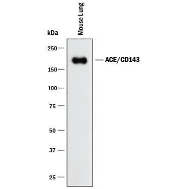 Western blot shows lysate of mouse lung tissue. PVDF membrane was probed with 2 µg/mL of Rat Anti-Mouse ACE/CD143 Monoclonal Antibody (Catalog # MAB1513) followed by HRP-conjugated Anti-Rat IgG Secondary Antibody (Catalog # HAF005). A specific band was detected for ACE/CD143 at approximately 180 kDa (as indicated). This experiment was conducted under reducing conditions and using Immunoblot Buffer Group 1.