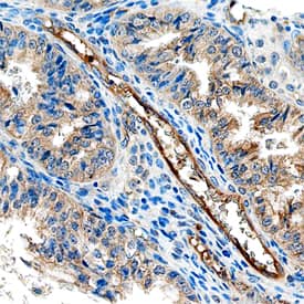 Immunohistochemistry ACP6 Antibody