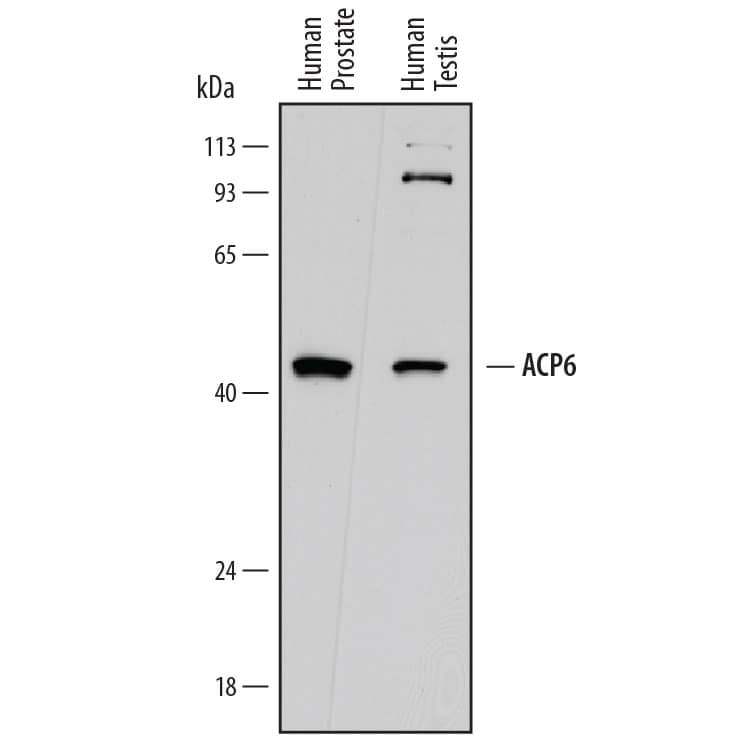 Western Blot ACP6 Antibody