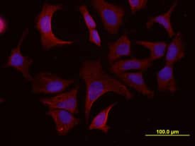 ADAM15 was detected in immersion fixed MCF-7 human breast cancer cell line using Human ADAM15 Ectodomain Monoclonal Antibody (Catalog # MAB935) at 10 µg/mL for 3 hours at room temperature. Cells were stained using the NorthernLights™ 557-conjugated Anti-Mouse IgG Secondary Antibody (red; NL007) and counterstained with DAPI (blue). View our protocol for Fluorescent ICC Staining of Cells on Coverslips.