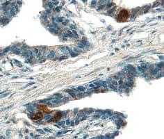 Immunohistochemistry ADAM15 Antibody (23G9) [Unconjugated]