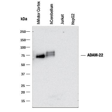 Western blot shows lysates of human brain (motor cortex) tissue, human brain (cerebellum) tissue, Jurkat human acute T cell leukemia cell line (negative control), and HepG2 human hepatocellular carcinoma cell line (negative control). PVDF membrane was probed with 2 µg/mL of Mouse Anti-Human ADAM22 Monoclonal Antibody (Catalog # MAB49081) followed by HRP-conjugated Anti-Mouse IgG Secondary Antibody (Catalog # HAF018). Specific bands were detected for ADAM22 at approximately 75 kDa (as indicated). This experiment was conducted under reducing conditions and using Immunoblot Buffer Group 1.