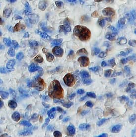 Immunohistochemistry ADAM23 Antibody (504425)