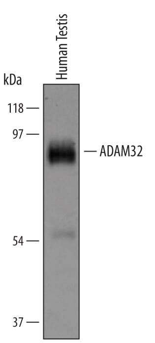 Western Blot ADAM32 Antibody