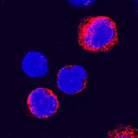 Immunocytochemistry ADAM8 Antibody [Unconjugated]