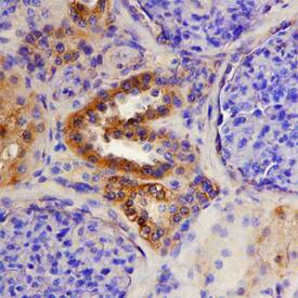 Immunohistochemistry ADAMTS15 Antibody (561819)