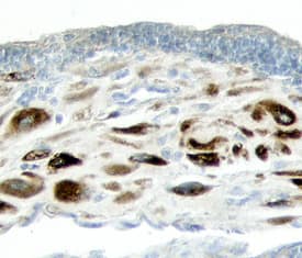 ADAMTS1 was detected in immersion fixed paraffin-embedded sections of human placenta using 15 &micro;g/mL Goat Anti-Human ADAMTS1 Propeptide Antigen Affinity-purified Polyclonal Antibody (Catalog # AF3079) overnight at 4 &deg;C. Tissue was stained with the Anti-Goat HRP-DAB Cell & Tissue Staining Kit (brown; Catalog # CTS008) and counterstained with hematoxylin (blue). View our protocol for Chromogenic IHC Staining of Paraffin-embedded Tissue Sections.