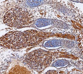 Immunohistochemistry ADAMTS1 Antibody