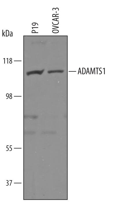 Western blot shows lysates of P19 mouse embryonal carcinoma cell line and OVCAR-3 human ovarian carcinoma cell line. PVDF Membrane was probed with 1 µg/mL of Sheep Anti-Human/Mouse ADAMTS1 Antigen Affinity-purified Polyclonal Antibody (Catalog # AF5867) followed by HRP-conjugated Anti-Sheep IgG Secondary Antibody (Catalog # HAF016). A specific band was detected for ADAMTS1 at approximately 110 kDa (as indicated). This experiment was conducted under reducing conditions and using Immunoblot Buffer Group 8.