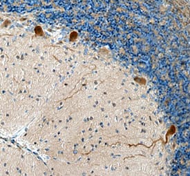Immunohistochemistry ADAMTS8 Antibody [Unconjugated]