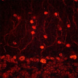 ADNP was detected in perfusion fixed frozen sections of mouse brain (cerebellum) using Goat Anti-Mouse/Rat ADNP Antigen Affinity-purified Polyclonal Antibody (Catalog # AF5919) at 1.7 µg/mL overnight at 4 °C. Tissue was stained using the NorthernLights™ 557-conjugated Anti-Goat IgG Secondary Antibody (red; Catalog # NL001). Specific staining was localized to Purkinje cells and neurons in molecular cell layer. View our protocol for Fluorescent IHC Staining of Frozen Tissue Sections.