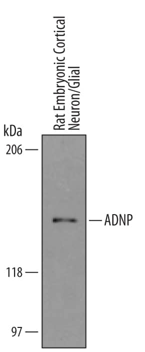 Western blot shows lysates of embryonic rat cortical neuron/ glial cells. PVDF membrane was probed with 1 µg/mL of Goat Anti-Mouse/Rat ADNP Antigen Affinity-purified Polyclonal Antibody (Catalog # AF5919) followed by HRP-conjugated Anti-Goat IgG Secondary Antibody (Catalog # HAF019). A specific band was detected for ADNP at approximately 150 kDa (as indicated). This experiment was conducted under reducing conditions and using Immunoblot Buffer Group 1.