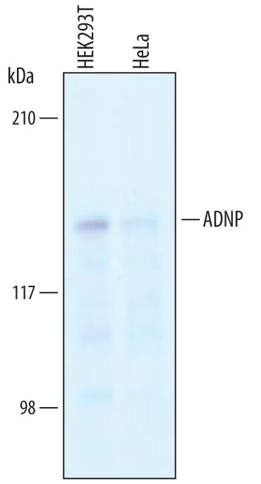 Western blot shows lysates of HEK293T human embryonic kidney cell line and HeLa human cervical epithelial carcinoma cell line. PVDF membrane was probed with 1 µg/mL of Goat Anti-Human ADNP Antigen Affinity-purified Polyclonal Antibody (Catalog # AF6737) followed by HRP-conjugated Anti-Goat IgG Secondary Antibody (Catalog # HAF019). A specific band was detected for ADNP at approximately 124 kDa (as indicated). This experiment was conducted under reducing conditions and using Immunoblot Buffer Group 1.