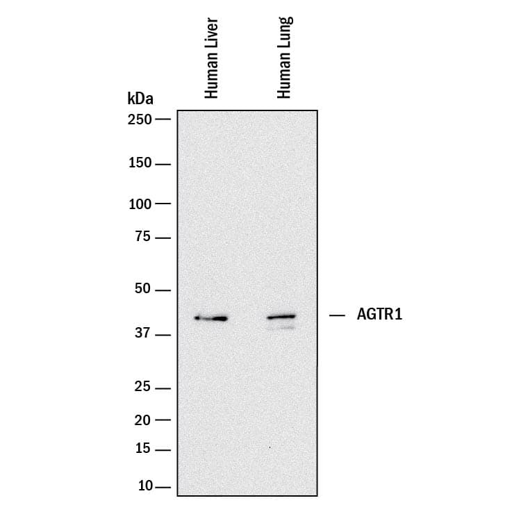Western Blot AGTR-1 Antibody (1010106) [Unconjugated]