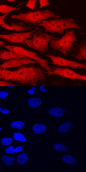 AHR was detected in immersion fixed HeLa human cervical epithelial carcinoma cell line using Sheep Anti-Human AHR Antigen Affinity-purified Polyclonal Antibody (Catalog # AF6185) at 10 µg/mL for 3 hours at room temperature. Cells were stained using the NorthernLights™ 557-conjugated Anti-Sheep IgG Secondary Antibody (red, upper panel; Catalog # NL010) and counterstained with DAPI (blue, lower panel). Specific staining was localized to nuclei and cytoplasm. View our protocol for Fluorescent ICC Staining of Cells on Coverslips.