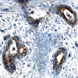 AHR was detected in immersion fixed paraffin-embedded sections of human pancreatic cancer tissue using Mouse Anti-Human AHR Monoclonal Antibody (Catalog # MAB6185) at 15 µg/mL overnight at 4 °C. Tissue was stained using the Anti-Mouse HRP-DAB Cell & Tissue Staining Kit (brown; Catalog # CTS002) and counterstained with hematoxylin (blue). Specific staining was localized to epithelial cells. View our protocol for Chromogenic IHC Staining of Paraffin-embedded Tissue Sections.