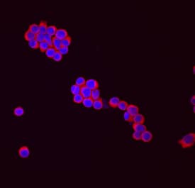 AICDA was detected in immersion fixed Ramos human Burkitt's lymphoma cell line using Rat Anti-Human AICDA Monoclonal Antibody (Catalog # MAB39102) at 10 µg/mL for 3 hours at room temperature. Cells were stained using the NorthernLights™ 557-conjugated Anti-Rat IgG Secondary Antibody (red; Catalog # NL013) and counterstained with DAPI (blue). Specific staining was localized to surface and cytoplasm. View our protocol for Fluorescent ICC Staining of Non-adherent Cells.