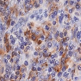 AIF-1/Iba1 was detected in immersion fixed paraffin-embedded sections of human spleen using Mouse Anti-Human AIF-1/Iba1 Monoclonal Antibody (Catalog # MAB7308) at 0.5 µg/mL for 1 hour at room temperature followed by incubation with the Anti-Mouse IgG VisUCyte™ HRP Polymer Antibody (Catalog # VC001). Tissue was stained using DAB (brown) and counterstained with hematoxylin (blue). Specific staining was localized to cytoplasm in splenocytes. View our protocol for IHC Staining with VisUCyte HRP Polymer Detection Reagents.