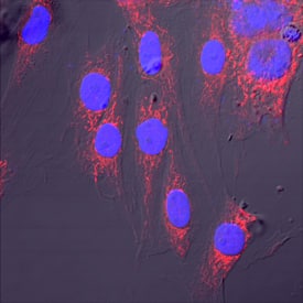 Immunocytochemistry AIF Antibody [Unconjugated]