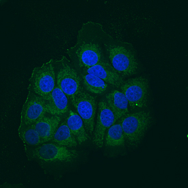 Immunocytochemistry AIF Antibody [Unconjugated]