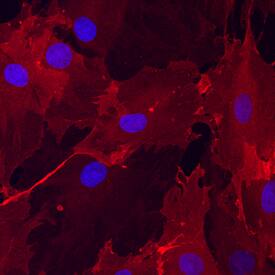 ALCAM/CD166 was detected in immersion fixed undifferentiated rat mesenchymal stem cells using Goat Anti-Mouse/Rat/Canine ALCAM/CD166 Antigen Affinity-purified Polyclonal Antibody (Catalog # AF1172) at 10 µg/mL for 3 hours at room temperature. Cells were stained using the NorthernLights™ 557-conjugated Anti-Goat IgG Secondary Antibody (red; Catalog # NL001) and counterstained with DAPI (blue). Specific staining was localized to cytoplasm. View our protocol for Fluorescent ICC Staining of Cells on Coverslips.