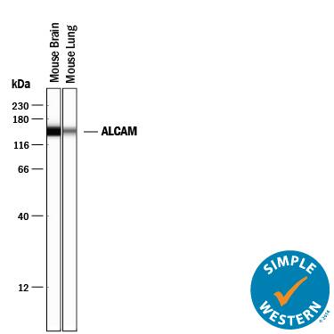 Simple Western lane view shows lysates of mouse brain tissue and mouse lung tissue loaded at 0.2 mg/mL. A specific band was detected for ALCAM/CD166 at approximately 149 kDa (as indicated) using 12.5 µg/mL of Goat Anti-Mouse/Rat/Canine ALCAM/CD166 Antigen Affinity-purified Polyclonal Antibody (Catalog # AF1172) followed by 1:50 dilution of HRP-conjugated Anti-Goat IgG Secondary Antibody (Catalog # HAF109). This experiment was conducted under reducing conditions and using the 12-230 kDa separation system.
