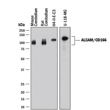 Western Blot ALCAM/CD166 Antibody [Unconjugated]
