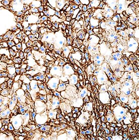 ALCAM/CD166 was detected in perfusion fixed frozen sections of mouse liver using Goat Anti-Mouse ALCAM/CD166 Biotinylated Antigen Affinity-purified Polyclonal Antibody (Catalog # BAF1172) at 5 µg/mL overnight at 4 °C. Tissue was stained using the Anti-Goat HRP-DAB Cell & Tissue Staining Kit (brown; Catalog # CTS008) and counterstained with hematoxylin (blue). Specific staining was localized to cytoplasm in hepatocytes. View our protocol for Chromogenic IHC Staining of Frozen Tissue Sections.